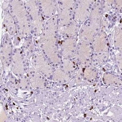 FOXB2 Antibody, Novus Biologicals 25 &mu;L, Unconjugated:Antibodies, Polyclonal