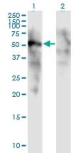 FOXD1 Antibody (2C10), Novus Biologicals 0.1 mg | Buy Online | Novus Biologicals | Fisher Scientific