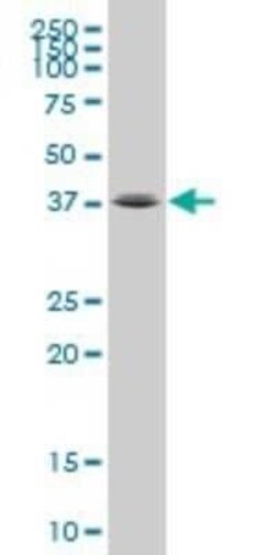 FOXL1 Antibody (1A7), Novus Biologicals 0.1 mg | Buy Online | Novus Biologicals | Fisher Scientific