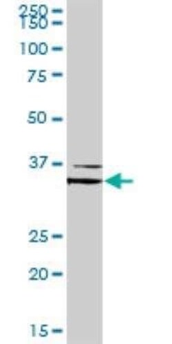FOXL1 Antibody, Novus Biologicals 0.1 mg | Buy Online | Novus Biologicals | Fisher Scientific