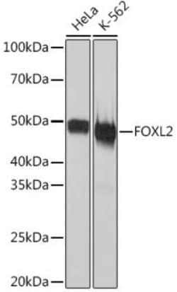 FOXL2 Rabbit anti-Human, Mouse, Rat, Clone: 4H5X3, Novus Biologicals 100