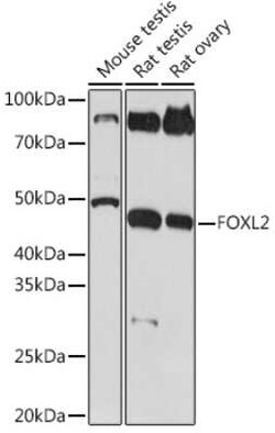 FOXL2 Rabbit anti-Human, Mouse, Rat, Clone: 4H5X3, Novus Biologicals 100