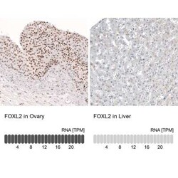 FOXL2 Antibody (CL12753), Novus Biologicals:Antibodies:Primary Antibodies