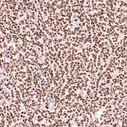 FOXL2 Antibody (CL12753), Novus Biologicals:Antibodies:Primary Antibodies
