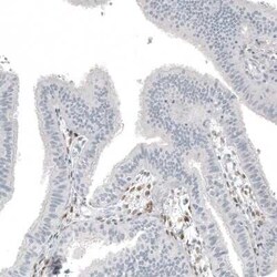 FOXL2 Antibody (CL12753), Novus Biologicals:Antibodies:Primary Antibodies