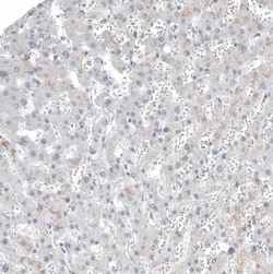 FOXL2 Antibody (CL12753), Novus Biologicals:Antibodies:Primary Antibodies