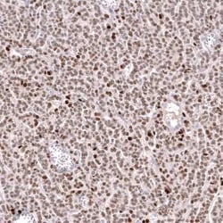 FOXL2 Antibody (CL12762), Novus Biologicals:Antibodies:Primary Antibodies