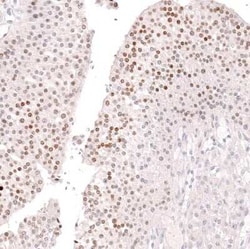 FOXL2 Antibody (CL12762), Novus Biologicals:Antibodies:Primary Antibodies