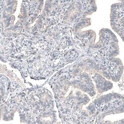 FOXL2 Antibody (CL12762), Novus Biologicals:Antibodies:Primary Antibodies