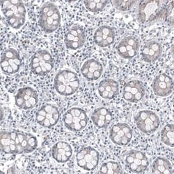 FOXL2 Antibody (CL12762), Novus Biologicals:Antibodies:Primary Antibodies