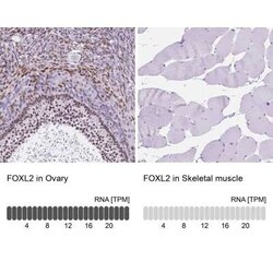 FOXL2 Antibody, Novus Biologicals 25 &mu;L, Unconjugated:Antibodies, Polyclonal