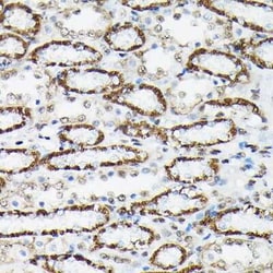 FOXO3 Rabbit anti-Human, Mouse, Rat, Polyclonal, Novus Biologicals:Antibodies:Primary