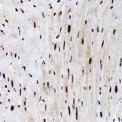 FOXO3 Rabbit anti-Human, Mouse, Rat, Polyclonal, Novus Biologicals:Antibodies:Primary