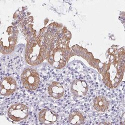 FPGS Antibody, Novus Biologicals:Antibodies:Primary Antibodies