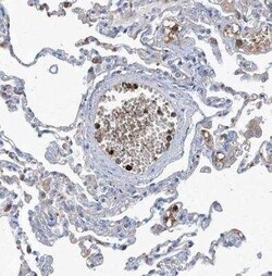 FPRL1/FPR2 Antibody, Novus Biologicals:Anticuerpos:Anticuerpos primarios