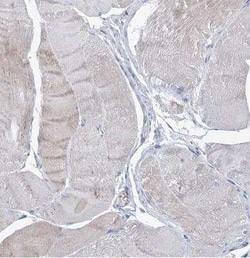 FPRL1/FPR2 Antibody, Novus Biologicals:Anticuerpos:Anticuerpos primarios