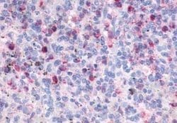 FPRL1/FPR2 Antibody, Novus Biologicals 50 &mu;g | Buy Online | Novus Biologicals | Fisher Scientific