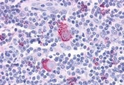 FPRL1/FPR2 Antibody, Novus Biologicals 50 &mu;g | Buy Online | Novus Biologicals | Fisher Scientific