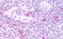 FPRL1/FPR2 Antibody, Novus Biologicals 50 &mu;g | Buy Online | Novus Biologicals | Fisher Scientific