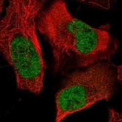 FRA-1/FOSL1 Rabbit anti-Human, Polyclonal, Novus Biologicals 25 &mu;g;