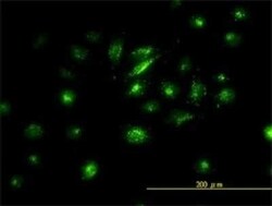 FRA2 Antibody (2B4-1C2), Novus Biologicals 0.1 mg | Buy Online | Novus Biologicals | Fisher Scientific