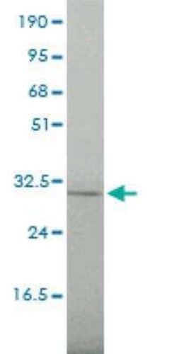 FRA2 Antibody (2B4-1C2), Novus Biologicals 0.1 mg | Buy Online | Novus Biologicals | Fisher Scientific