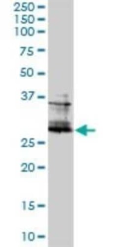 FRA2 Antibody (2B4-1C2), Novus Biologicals 0.1 mg | Buy Online | Novus Biologicals | Fisher Scientific