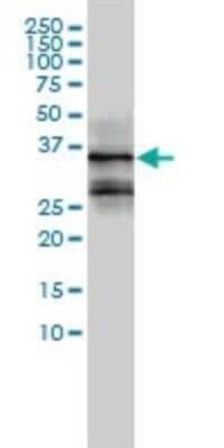 FRA2 Antibody (2B4-1C2), Novus Biologicals 0.1 mg | Buy Online | Novus Biologicals | Fisher Scientific