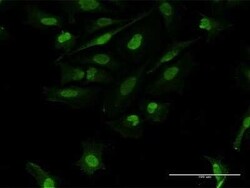 FRA2 Antibody, Novus Biologicals 0.05 mg; Unconjugated:Antibodies, Polyclonal
