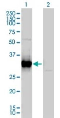 FRG1 Antibody (4A5), Novus Biologicals 0.1 mg | Buy Online | Novus Biologicals | Fisher Scientific