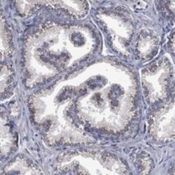 FRG1 Rabbit anti-Human, Polyclonal, Novus Biologicals:Antibodies:Primary