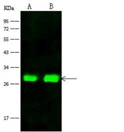 FRG1 Antibody, Novus Biologicals 50 &mu;g | Buy Online | Novus Biologicals | Fisher Scientific