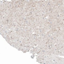 FRMD5 Antibody (CL9503), Novus Biologicals 100 &mu;L; Unconjugated:Antibodies,