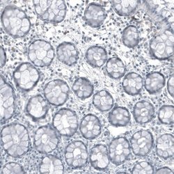 FRMD5 Antibody (CL9503), Novus Biologicals 100 &mu;L; Unconjugated:Antibodies,