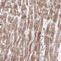 FRMD5 Antibody (CL9503), Novus Biologicals 100 &mu;L; Unconjugated:Antibodies,