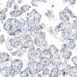 FRMD5 Antibody (CL9503), Novus Biologicals 100 &mu;L; Unconjugated:Antibodies,