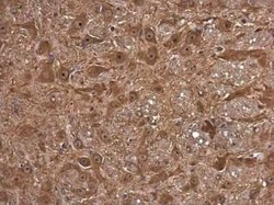 FSD1 Antibody, Novus Biologicals 100 &mu;g | Buy Online | Novus Biologicals | Fisher Scientific