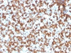 FSH beta Rabbit anti-Human, Clone: FSHb/2033R, Novus Biologicals 20 &mu;g;