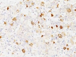 FSH beta Antibody (SPM107), Novus Biologicals 0.1mg; Unlabeled:Antibodies,