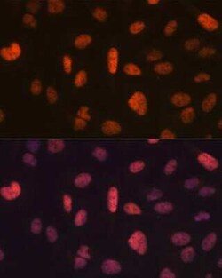 FTO Rabbit anti-Human, Clone: 2Q9K10, Novus Biologicals:Antibodies:Primary