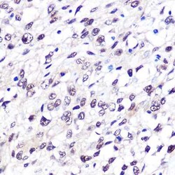 FTO Rabbit anti-Human, Clone: 2Q9K10, Novus Biologicals:Antibodies:Primary