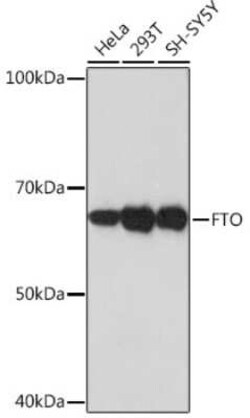 FTO Rabbit anti-Human, Clone: 2Q9K10, Novus Biologicals:Antibodies:Primary