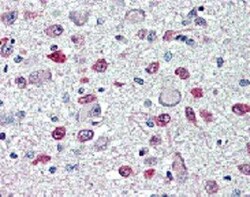 FTO, Mouse anti-Human, Clone: AG103, Novus Biologicals:Antibodies:Primary