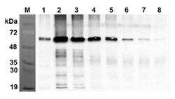 FTO, Mouse anti-Human, Clone: AG103, Novus Biologicals:Antibodies:Primary