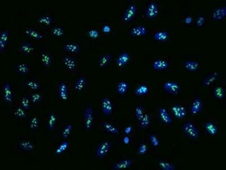 FTSJ3 Antibody, Novus Biologicals:Antibodies:Primary Antibodies