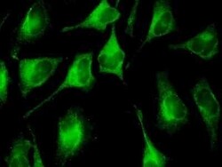 FUBI/MNSF beta/FAU Antibody (3C10), Novus Biologicals 0.1 mg | Buy Online | Novus Biologicals | Fisher Scientific