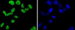 FUBP1 Rabbit anti-Human, Clone: SY11-04, Novus Biologicals 100&mu;L:Antibodies,