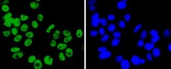 FUBP1 Rabbit anti-Human, Clone: SY11-04, Novus Biologicals 100&mu;L:Antibodies,