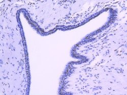 FUBP1 Rabbit anti-Human, Clone: SY11-04, Novus Biologicals 100&mu;L:Antibodies,