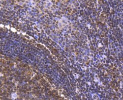 FUBP1 Rabbit anti-Human, Clone: SY11-04, Novus Biologicals 100&mu;L:Antibodies,